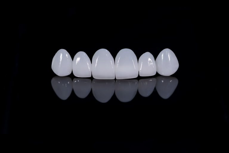 Zirkonyum Dişler 9 dental veneers